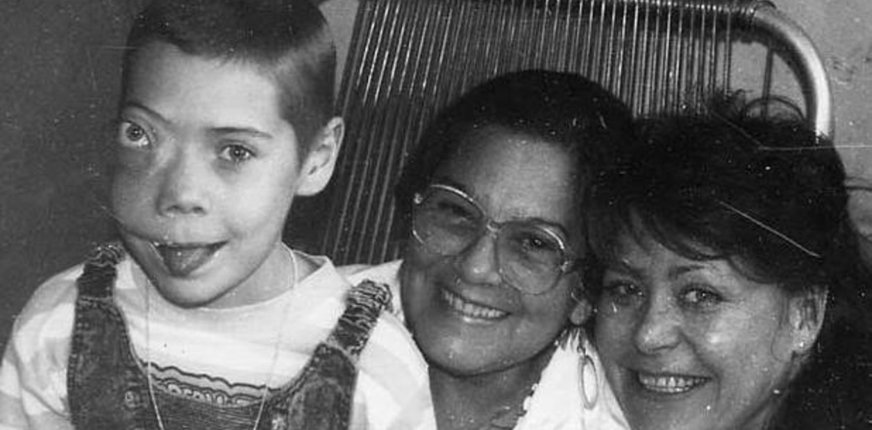 una-victima-de-chernobil-luego___bJDS-siGW_1256x620__1