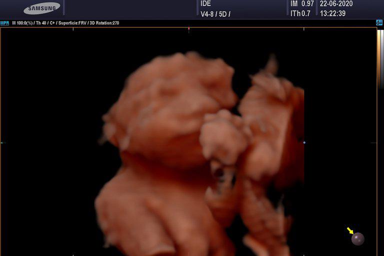 4JKKW455P5HMPBTHBKH6EJ5CDU