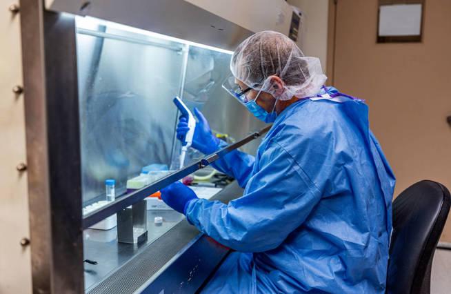 a-researcher-at-the-university-of-pittsburgh-works-on-a-covid-19-vaccine-candidate-a-fingertip-sized-patch-with-dissolvable-microscopic-needles-in-pittsburgh-pennsylvania-u-s-march-28-2020-upmc-hand