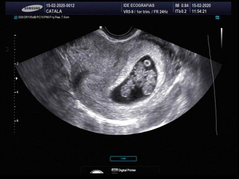 WJRBMAUJ6NGCHPOVVSQ2YEPHOE