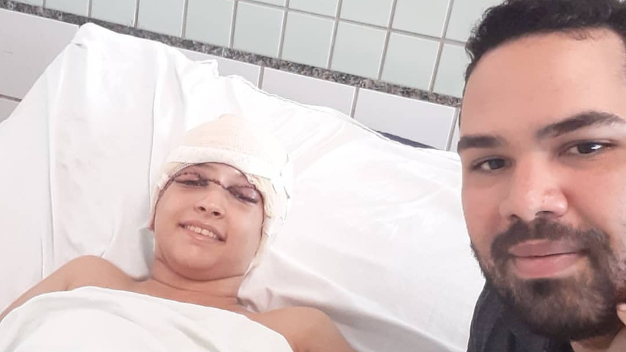 debora-stefanny-dantas-de-oliveira-teve-couro-cabeludo-arrancado-por-kart-1565811918650_v2_900x506