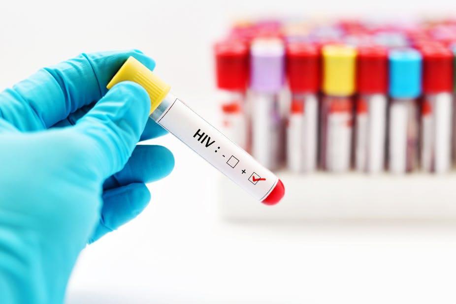HIV